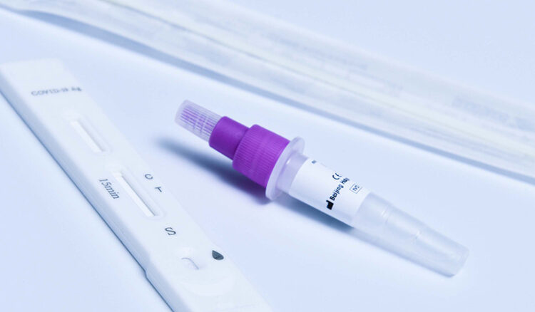 Registra Salud una persona hospitalizada por dengue