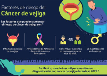 Dolor y sangre en la orina puede indicar la presencia de cáncer de vejiga