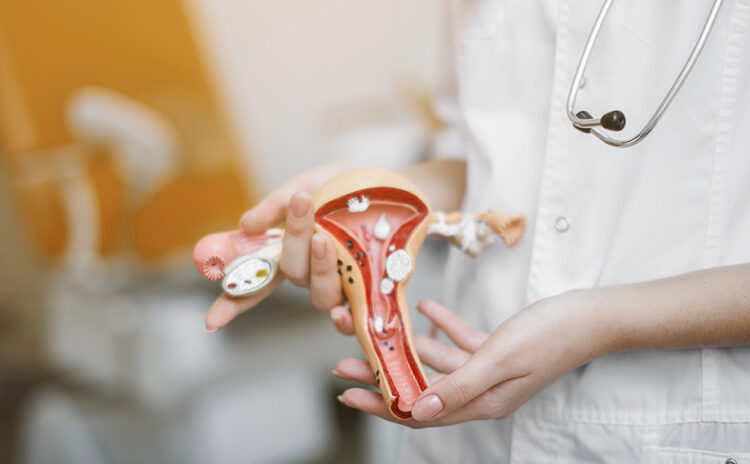 Salud de la Mujer: Enfoque en Cáncer Cervicouterino