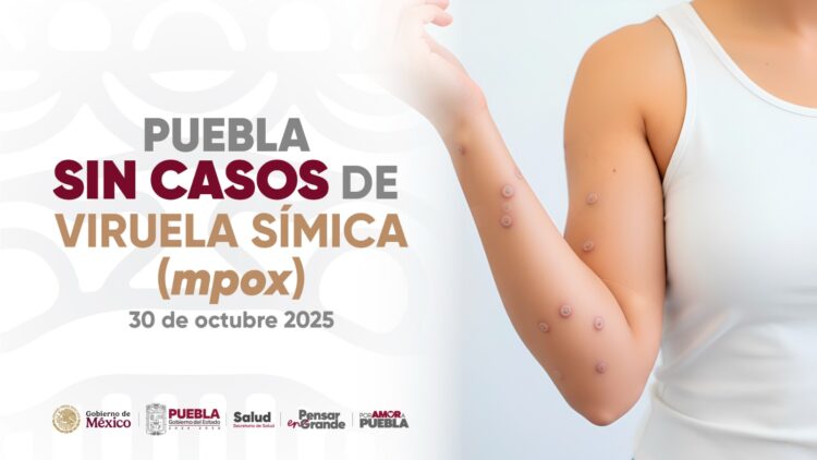 Secretaría de Salud descarta presencia de viruela símica en escuelas de Puebla