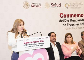 SEDIF y Beneficencia Pública Nacional transforman vidas de niñas y niños con Síndrome de Treacher Collins