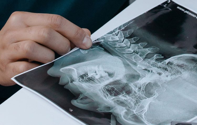 Especialistas alertan: el VPH cambia el perfil del cáncer de orofaringe y dispara los casos en hombres