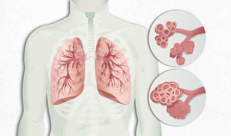 Innovador medicamento para Fibrosis Pulmonar podría extender la supervivencia hasta más de 5 años